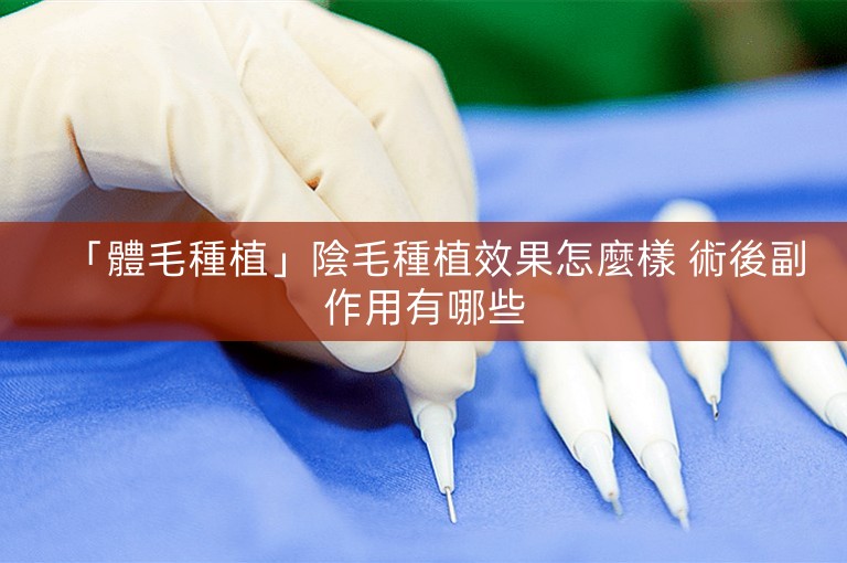 「體毛種植」陰毛種植效果怎麼樣 術後副作用有哪些 「體毛種植」陰毛種植效果怎麼樣 術後副作用有哪些