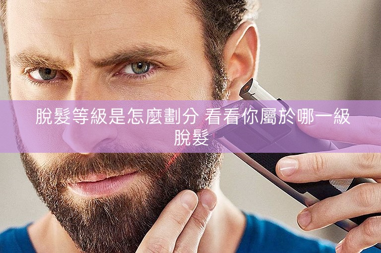  脫髮等級是怎麼劃分 看看你屬於哪一級脫髮