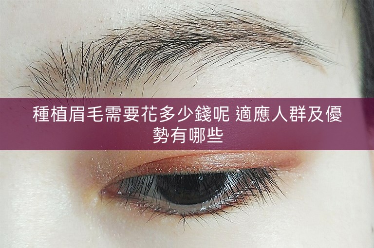 種植眉毛需要花多少錢呢 適應人群及優勢有哪些