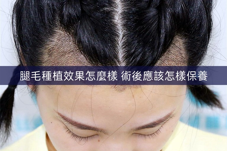 腿毛種植效果怎麼樣 術後應該怎樣保養 腿毛種植效果怎麼樣 術後應該怎樣保養