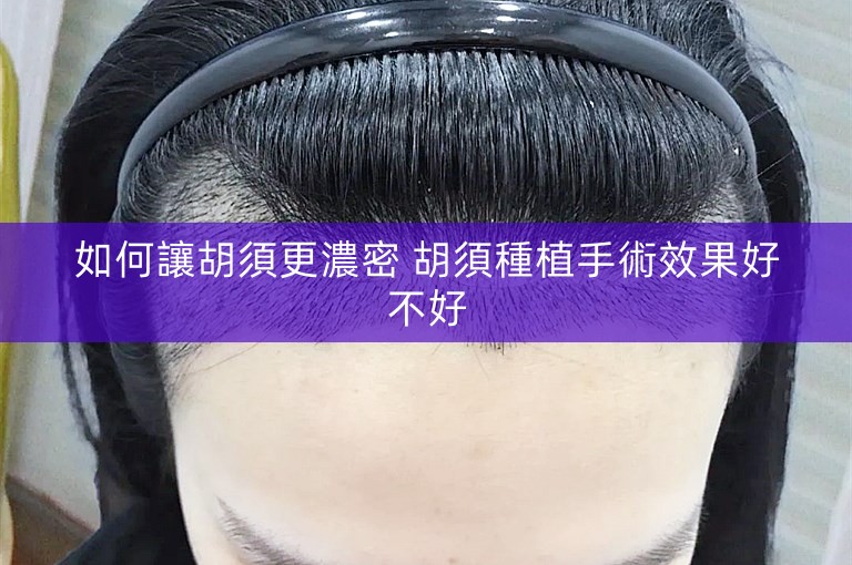 如何讓胡須更濃密 胡須種植手術效果好不好