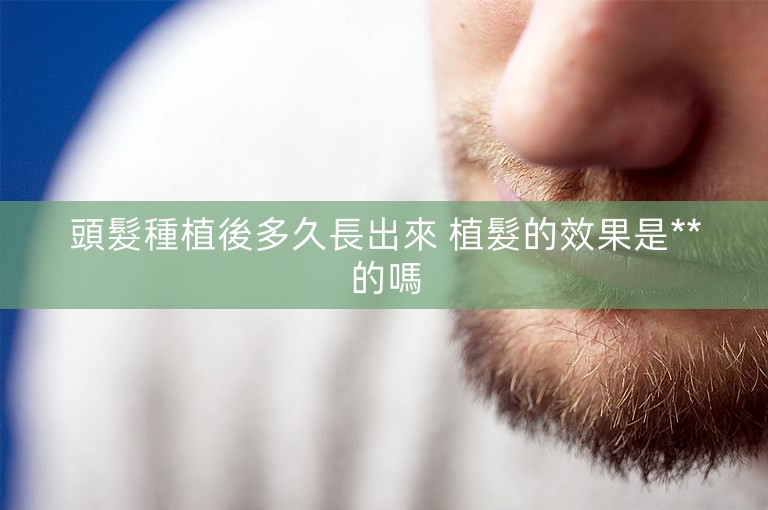 頭髮種植後多久長出來 植髮的效果是**的嗎 頭髮種植後多久長出來 植髮的效果是**的嗎