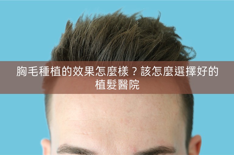 胸毛種植的效果怎麼樣？該怎麼選擇好的植髮醫院