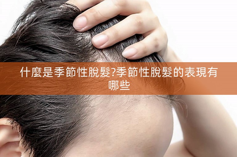 什麼是季節性脫髮?季節性脫髮的表現有哪些
