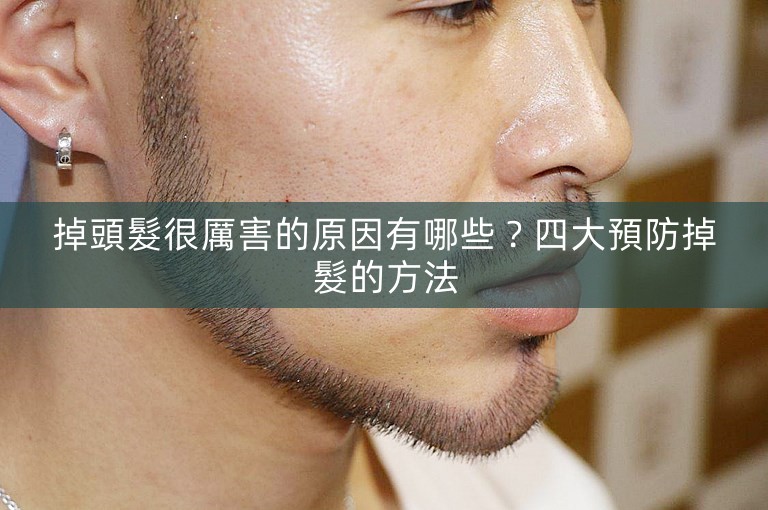 掉頭髮很厲害的原因有哪些？四大預防掉髮的方法