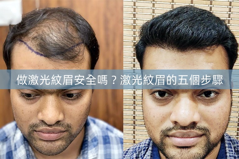 做激光紋眉安全嗎?激光紋眉的五個步驟 做激光紋眉安全嗎?激光紋眉的五個步驟