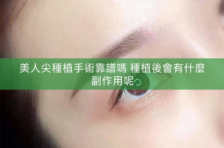 美人尖種植手術靠譜嗎 種植後會有什麼副作用呢