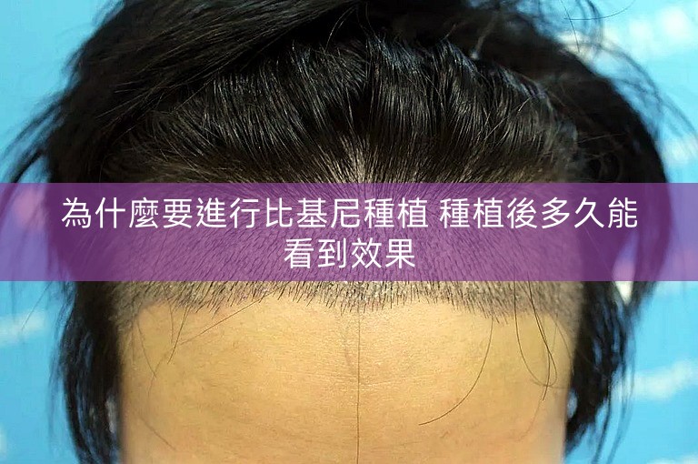 為什麼要進行比基尼種植 種植後多久能看到效果 為什麼要進行比基尼種植 種植後多久能看到效果