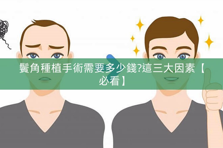 鬢角種植手術需要多少錢?這三大因素【必看】