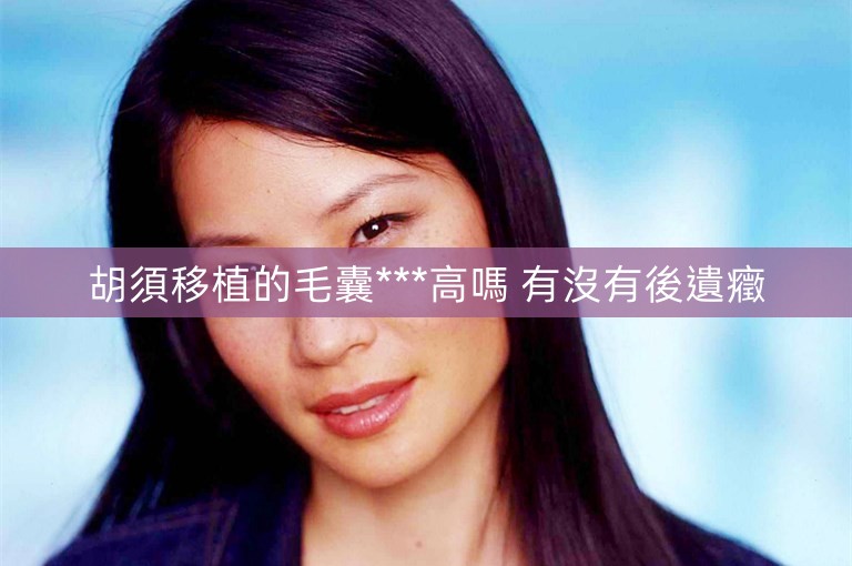 胡須移植的毛囊***高嗎 有沒有後遺癥