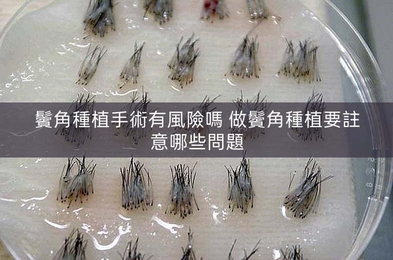 鬢角種植手術有風險嗎 做鬢角種植要註意哪些問題