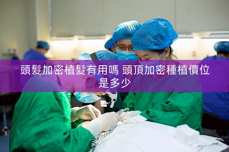 頭髮加密植髮有用嗎 頭頂加密種植價位是多少