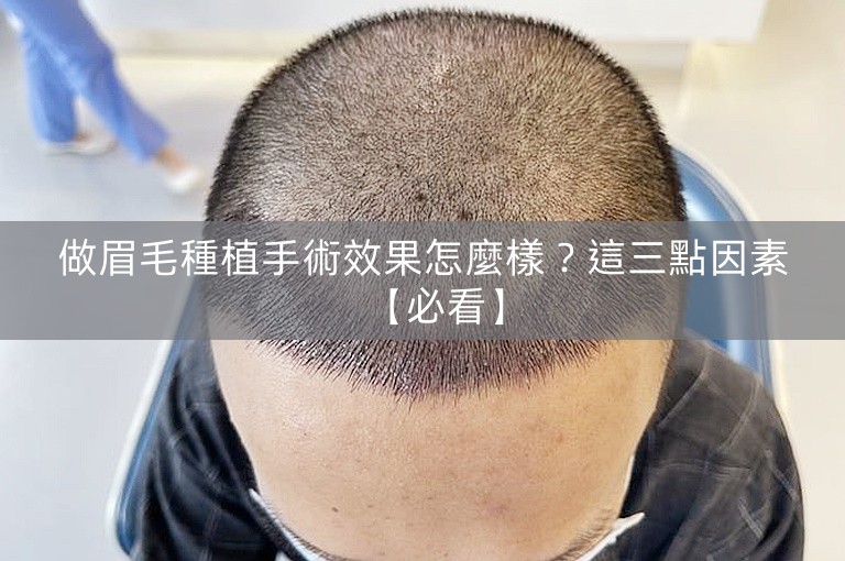 做眉毛種植手術效果怎麼樣？這三點因素【必看】
