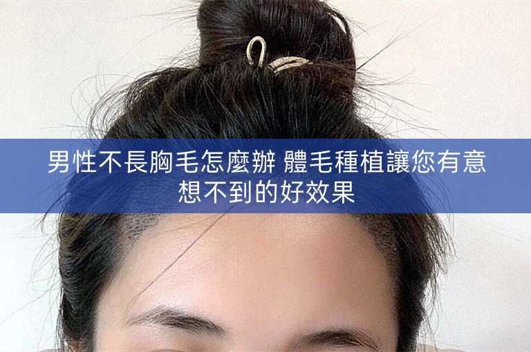 男性不長胸毛怎麼辦 體毛種植讓您有意想不到的好效果