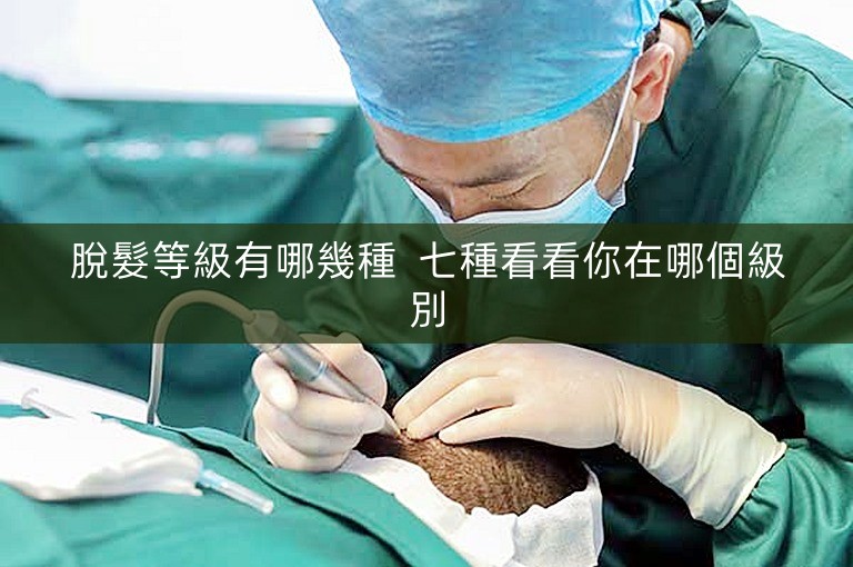 脫髮等級有哪幾種 七種看看你在哪個級別 脫髮等級有哪幾種 七種看看你在哪個級別