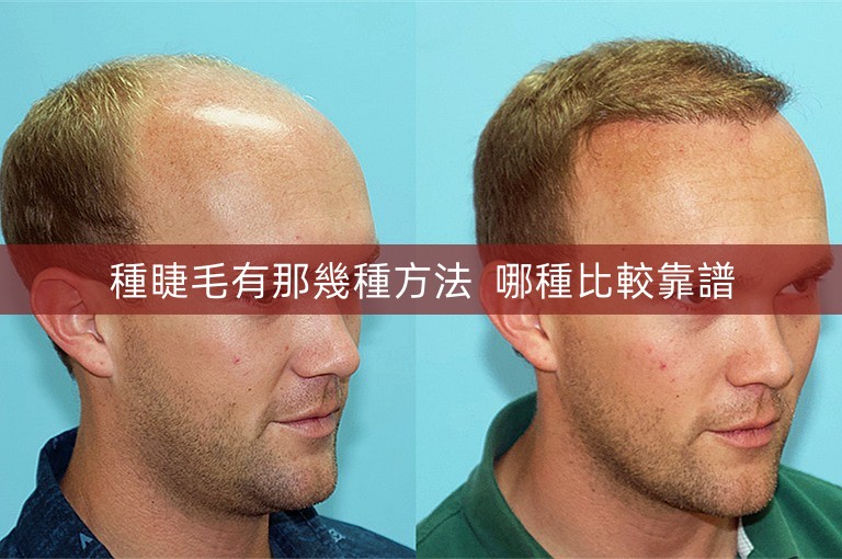 種睫毛有那幾種方法 哪種比較靠譜 種睫毛有那幾種方法 哪種比較靠譜