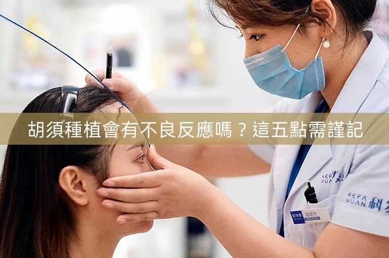 胡須種植會有不良反應嗎？這五點需謹記