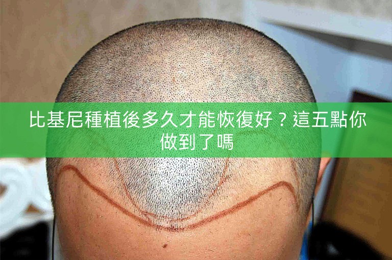 比基尼種植後多久才能恢復好？這五點你做到了嗎