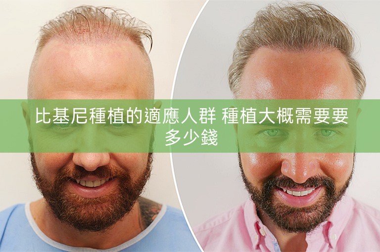 比基尼種植的適應人群 種植大概需要要多少錢