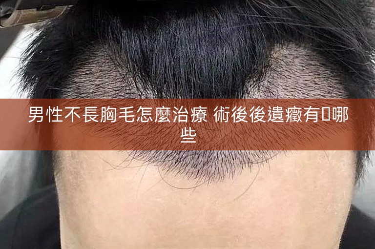 男性不長胸毛怎麼治療 術後後遺癥有​哪些