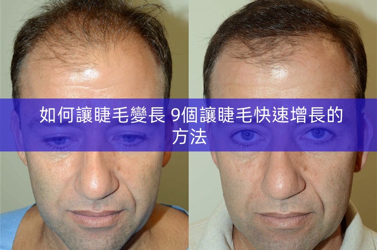 如何讓睫毛變長 9個讓睫毛快速增長的方法 如何讓睫毛變長 9個讓睫毛快速增長的方法