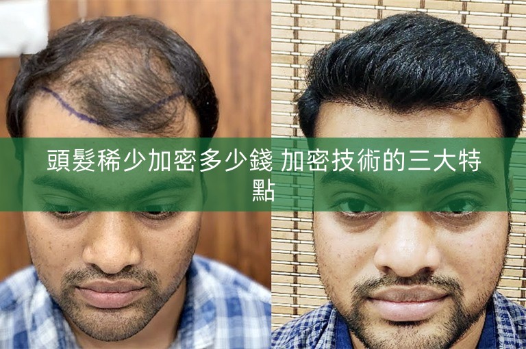 頭髮稀少加密多少錢 加密技術的三大特點