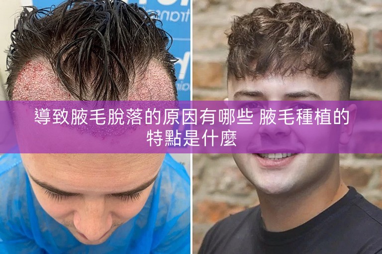 導致腋毛脫落的原因有哪些 腋毛種植的特點是什麼