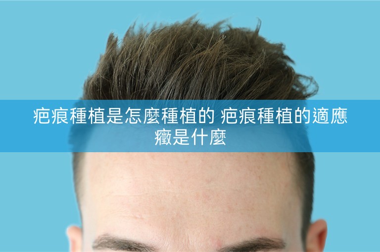 疤痕種植是怎麼種植的 疤痕種植的適應癥是什麼