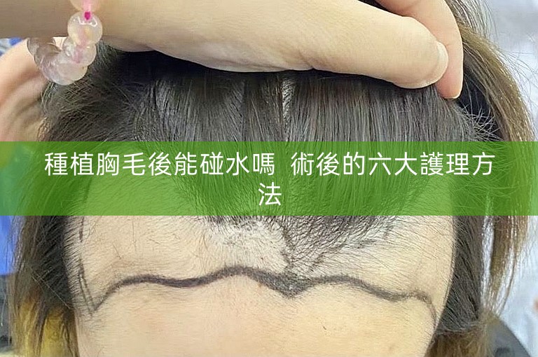 種植胸毛後能碰水嗎 術後的六大護理方法 種植胸毛後能碰水嗎 術後的六大護理方法