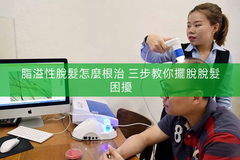 脂溢性脫髮怎麼根治 三步教你擺脫脫髮困擾