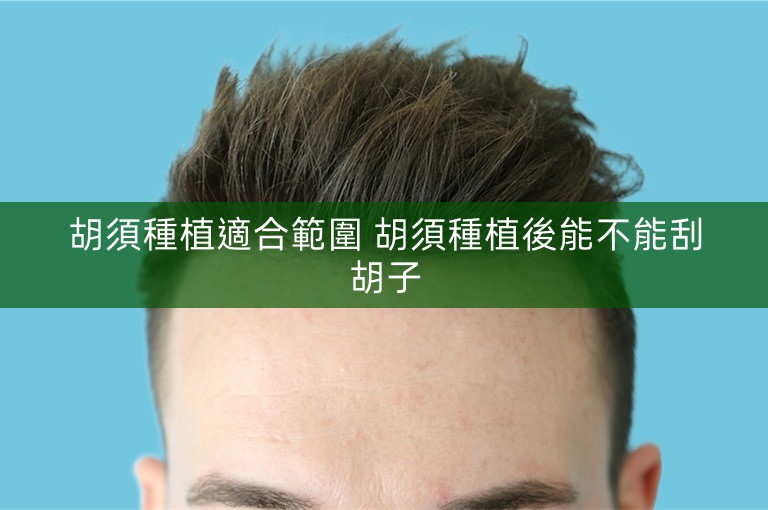 胡須種植適合範圍 胡須種植後能不能刮胡子 胡須種植適合範圍 胡須種植後能不能刮胡子