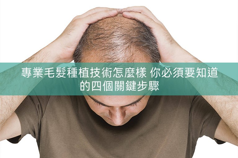專業毛髮種植技術怎麼樣 你必須要知道的四個關鍵步驟