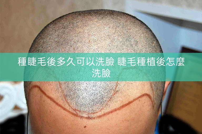 種睫毛後多久可以洗臉 睫毛種植後怎麼洗臉