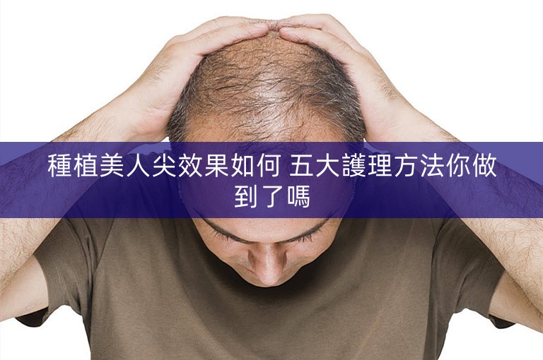 種植美人尖效果如何 五大護理方法你做到了嗎