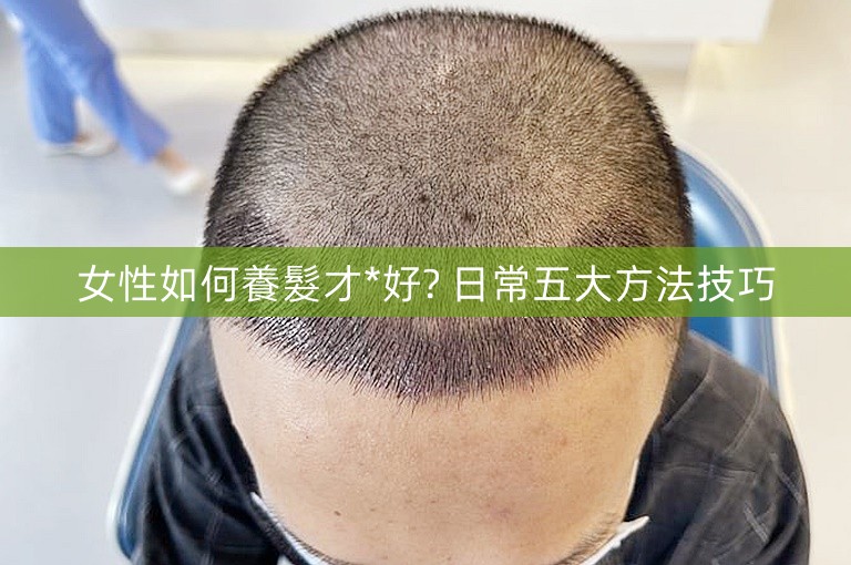 女性如何養髮才*好? 日常五大方法技巧