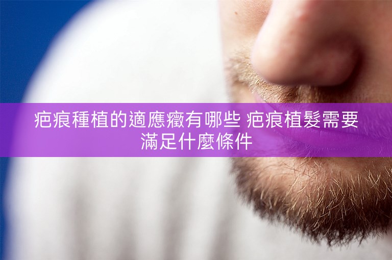 疤痕種植的適應癥有哪些 疤痕植髮需要滿足什麼條件