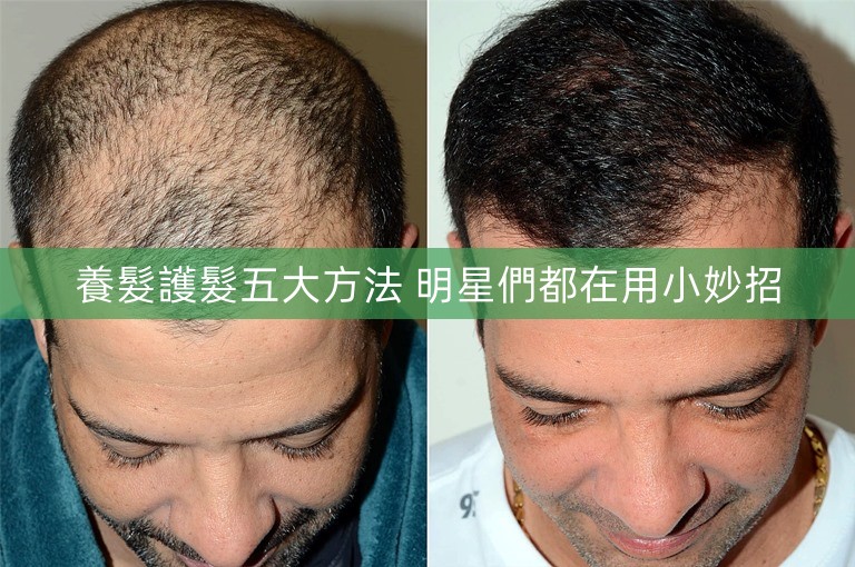 養髮護髮五大方法 明星們都在用小妙招 養髮護髮五大方法 明星們都在用小妙招