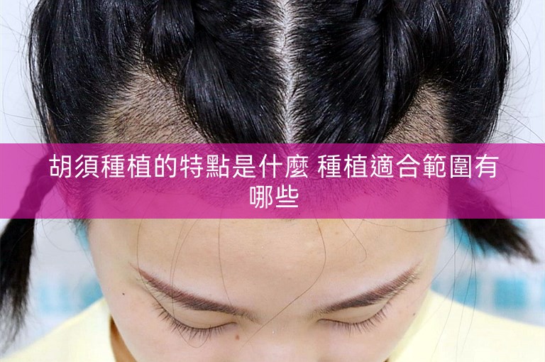 胡須種植的特點是什麼 種植適合範圍有哪些 胡須種植的特點是什麼 種植適合範圍有哪些