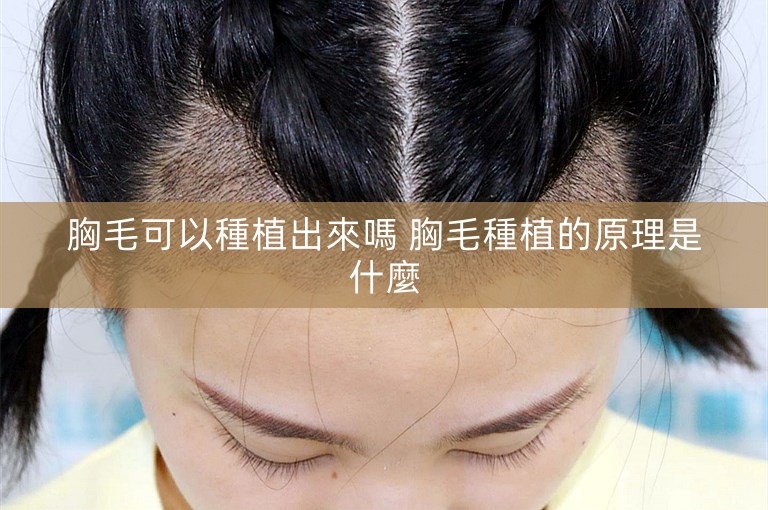 胸毛可以種植出來嗎 胸毛種植的原理是什麼 胸毛可以種植出來嗎 胸毛種植的原理是什麼