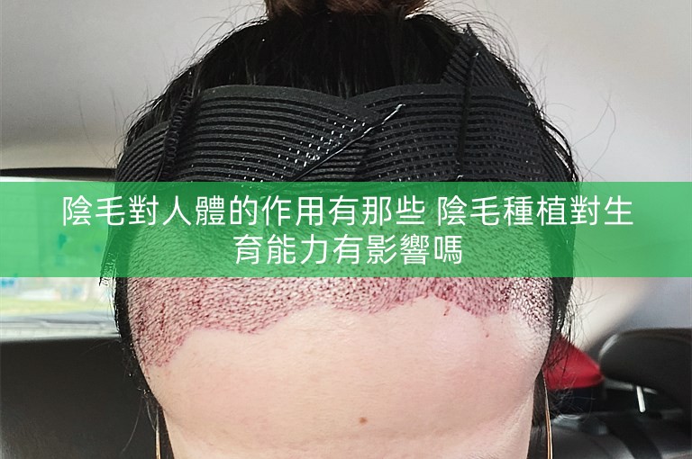 陰毛對人體的作用有那些 陰毛種植對生育能力有影響嗎 陰毛對人體的作用有那些 陰毛種植對生育能力有影響嗎