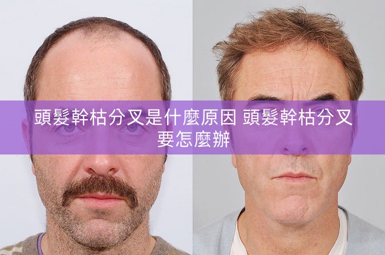 頭髮幹枯分叉是什麼原因 頭髮幹枯分叉要怎麼辦 頭髮幹枯分叉是什麼原因 頭髮幹枯分叉要怎麼辦