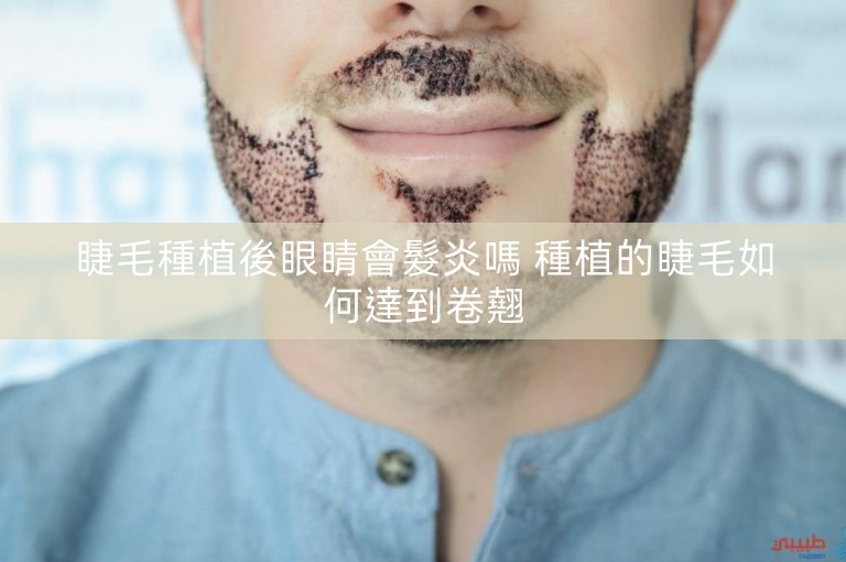 睫毛種植後眼睛會髮炎嗎 種植的睫毛如何達到卷翹