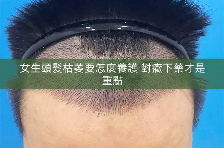 女生頭髮枯萎要怎麼養護 對癥下藥才是重點 女生頭髮枯萎要怎麼養護 對癥下藥才是重點