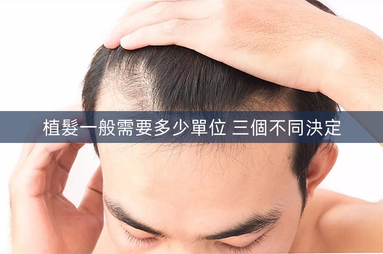 植髮一般需要多少單位 三個不同決定