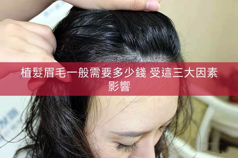 植髮眉毛一般需要多少錢 受這三大因素影響