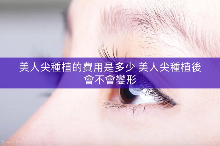 美人尖種植的費用是多少 美人尖種植後會不會變形