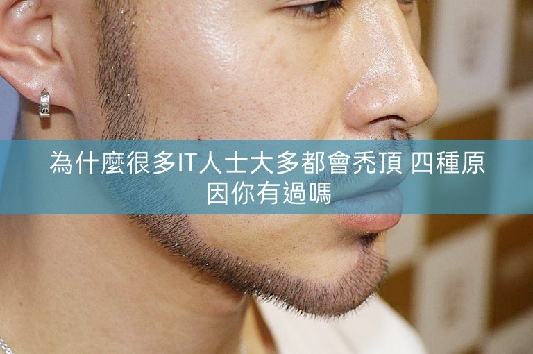 為什麼很多IT人士大多都會禿頂 四種原因你有過嗎