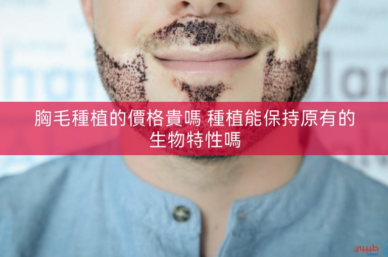 胸毛種植的價格貴嗎 種植能保持原有的生物特性嗎