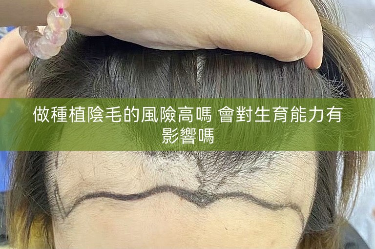做種植陰毛的風險高嗎 會對生育能力有影響嗎 做種植陰毛的風險高嗎 會對生育能力有影響嗎