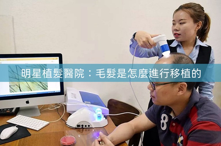 明星植髮醫院：毛髮是怎麼進行移植的